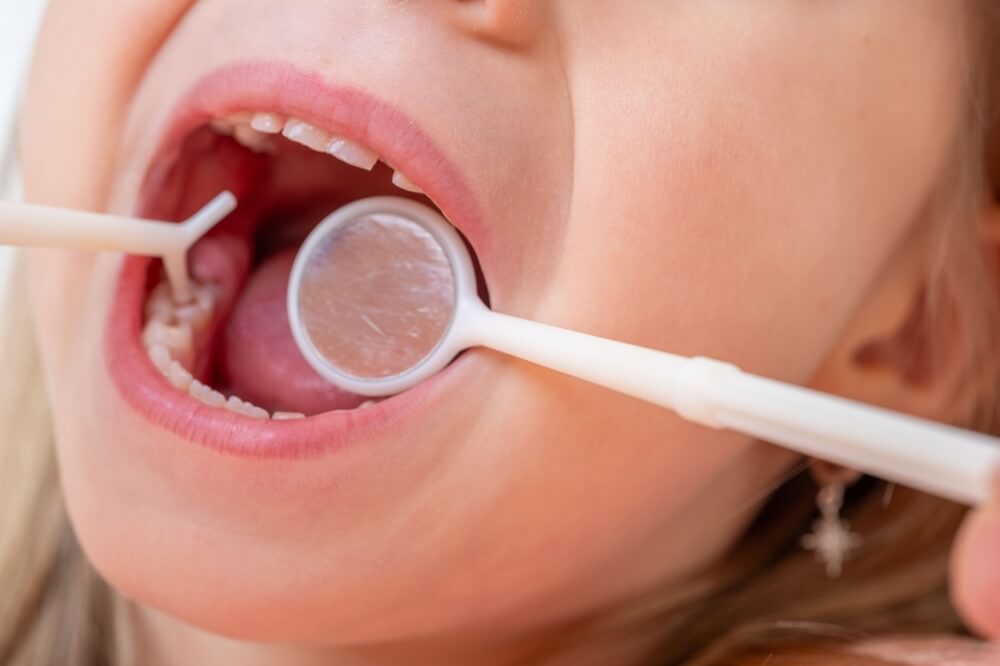 Preventative dentristry