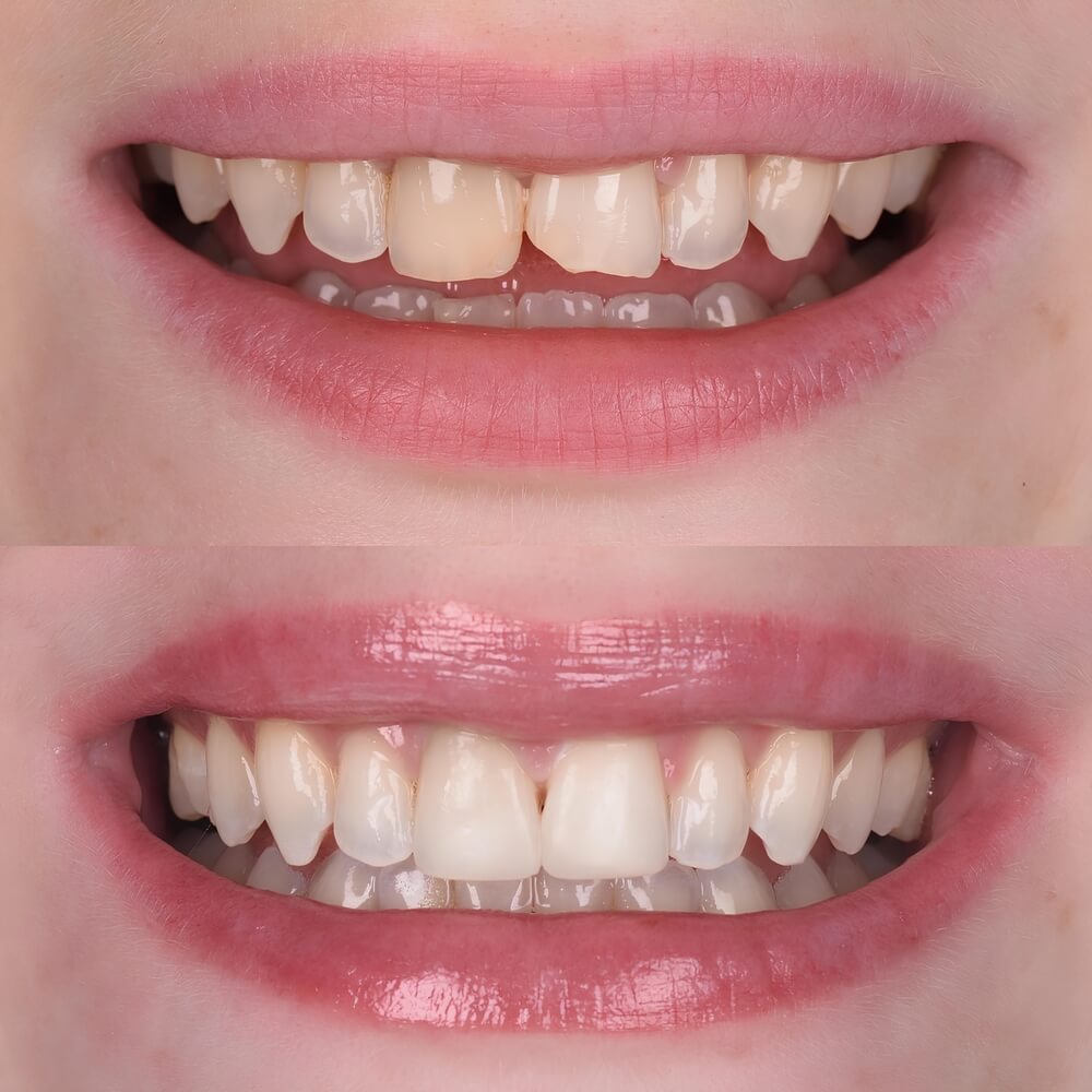 restorative dentristry